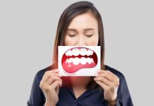 Root causes of mouth most cancers and tricks to forestall it