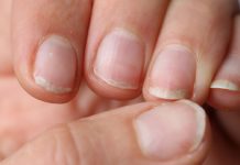 Easy methods to stop brittle nails: 5 tricks to observe