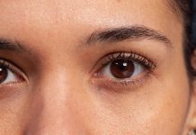 Beware of those eye situations after you flip 40