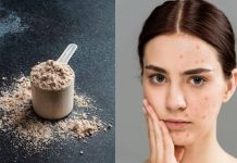 Whey protein negative effects on pores and skin: Can it trigger pimples?