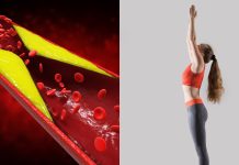Strive these yoga poses for ldl cholesterol management