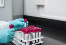 ‘Unhealthy’ ldl cholesterol not the one wrongdoer linked with a better chance of coronary heart illness