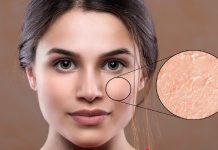 5 greatest pores and skin peeling merchandise