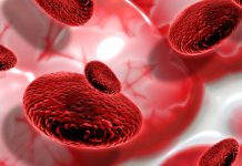 Blood Clot: What’s it, Signs, Causes