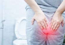 Rectal Ache: What’s it, Causes, Therapy, Prevention