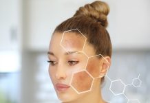 How one can scale back melanin to manage pores and skin pigmentation?