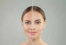3 varieties of wrinkles and how you can do away with them