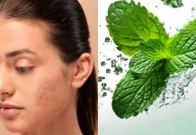 5 easy methods to make use of mint leaves to scale back zits scars