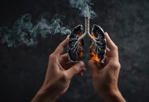 World Lung Most cancers Day: 9 myths about lung most cancers debunked