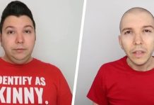 YouTuber Nikocado Avocado loses 114 kg in 2 years: Is that this a wholesome weight reduction price?