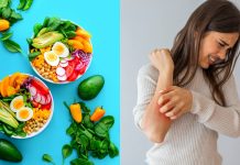 Psoriasis weight loss plan: What to eat, what to keep away from