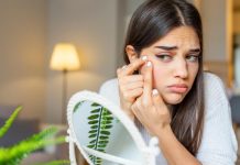 Benzoyl peroxide for pimples: Advantages and the way to use