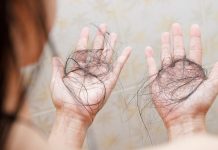 The rise of autoimmune hair loss: Causes and coverings