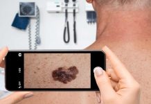 Must you keep away from AI pores and skin apps? A dermatologist solutions