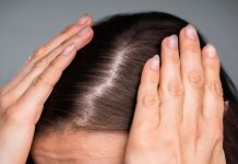 7 causes for hair fall throughout festive season and tricks to forestall it