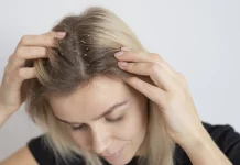 6 fast fixes for shiny, sticky dandruff and a flake-free scalp