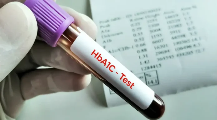 The influence of anaemia on HbA1c and diabetes administration