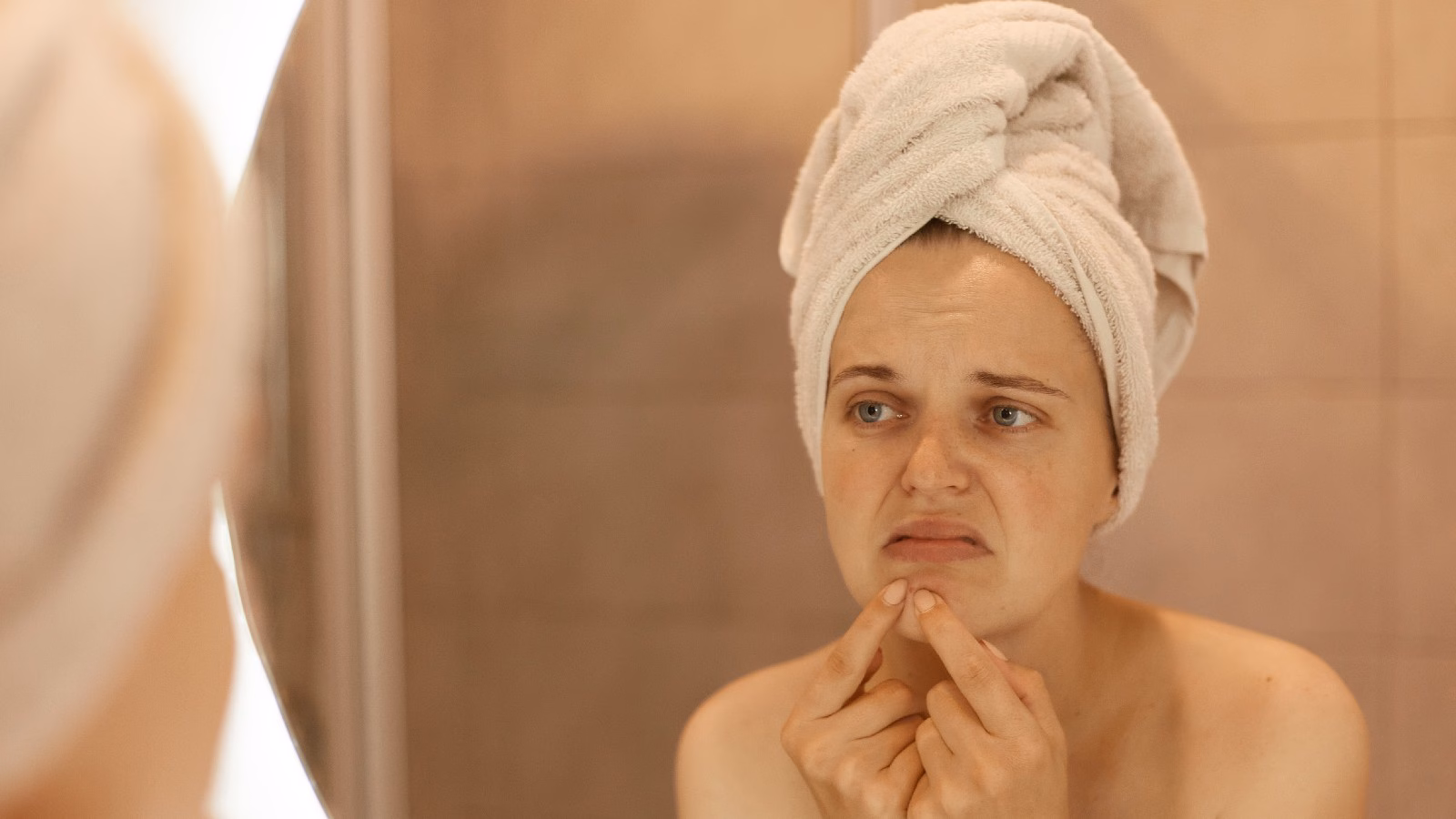 Intestine-skin connection: Pimples causes past the floor