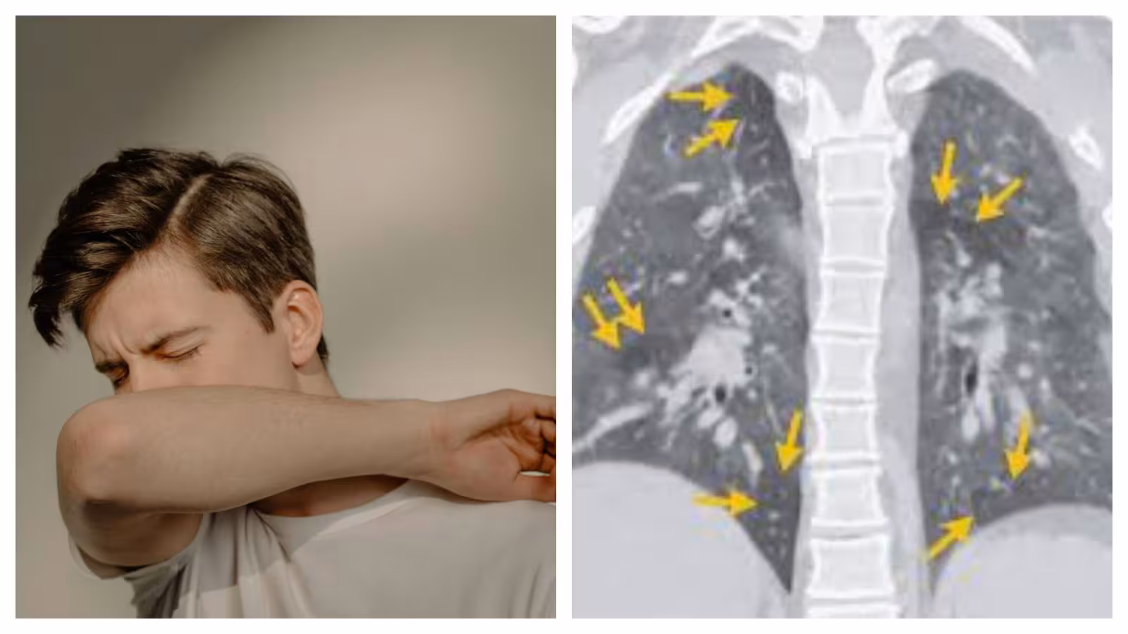 Defending lungs: Results of warmth and El Niño on respiratory well being