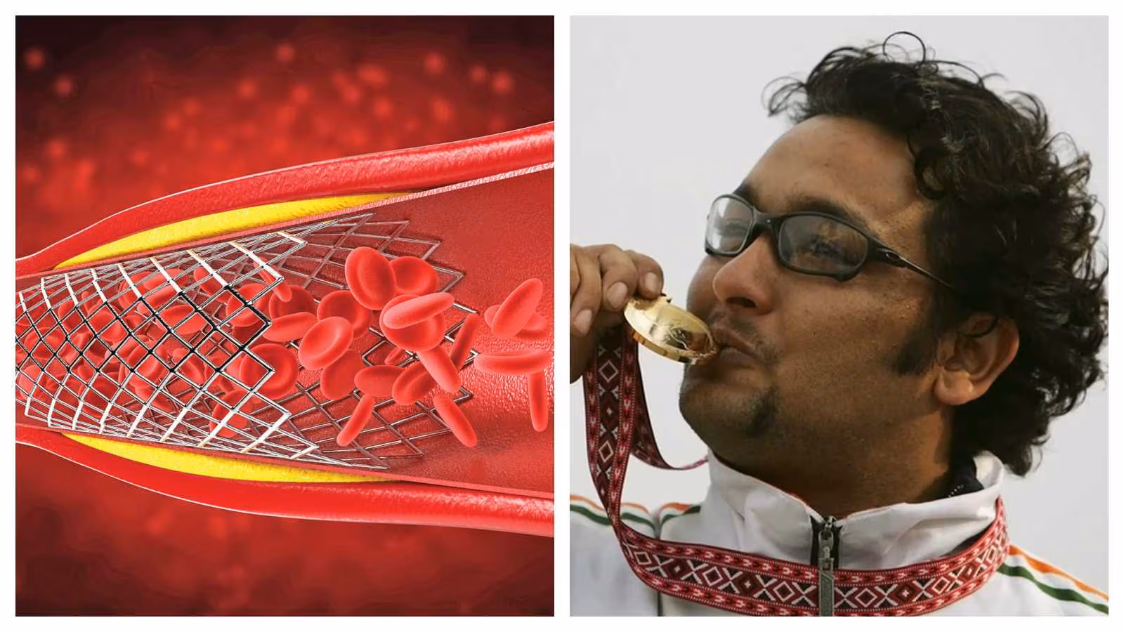 Cardiac rupture: Dangers, signs, and life-saving therapies