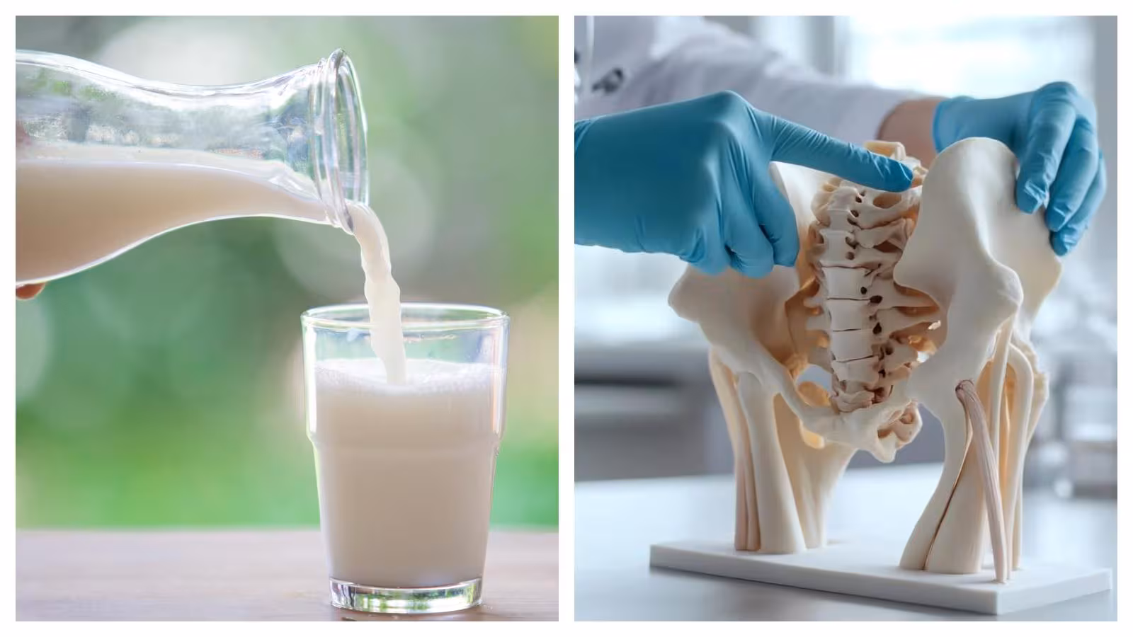 Does milk consumption enhance osteoporosis danger?