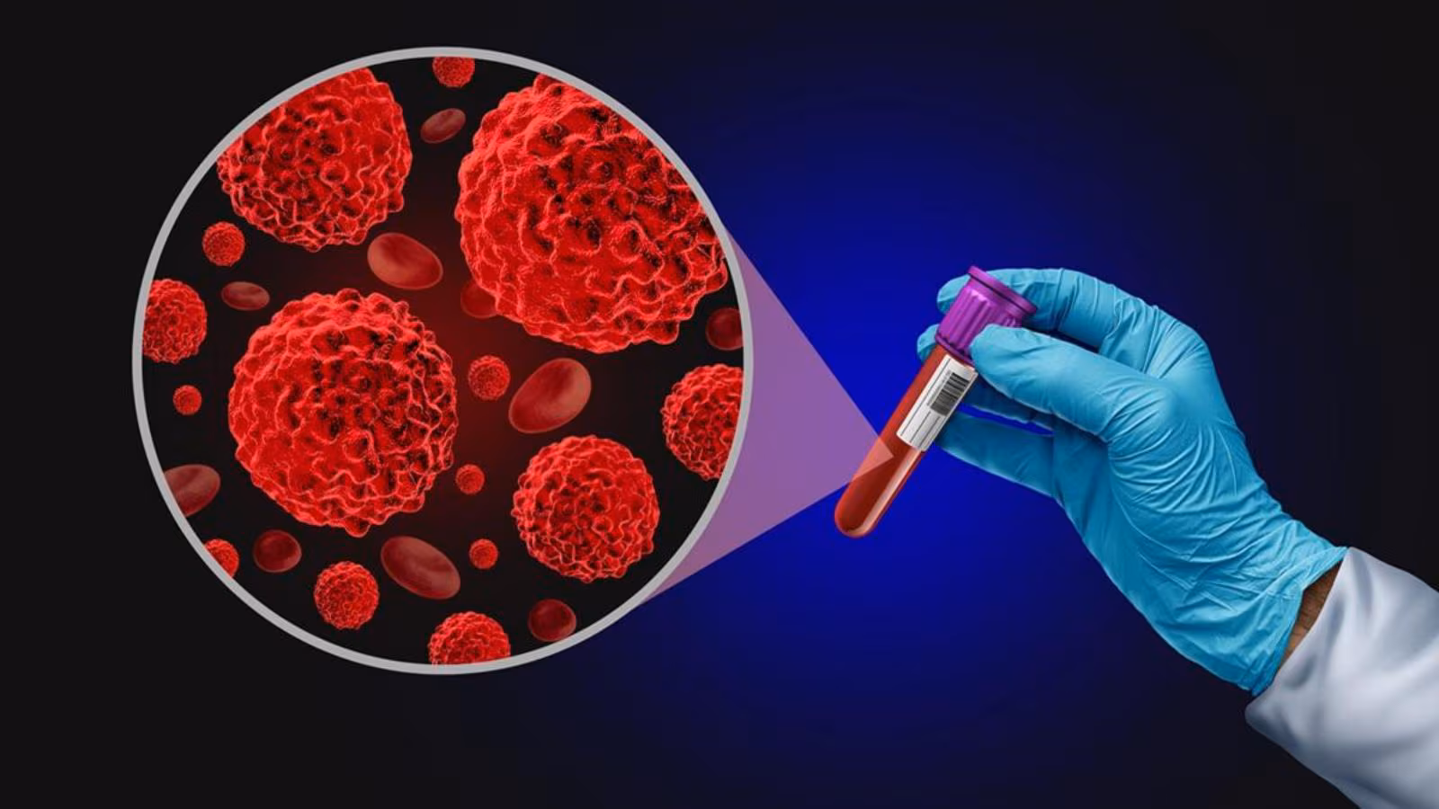 Most cancers detection future: How liquid biopsies are altering the sport