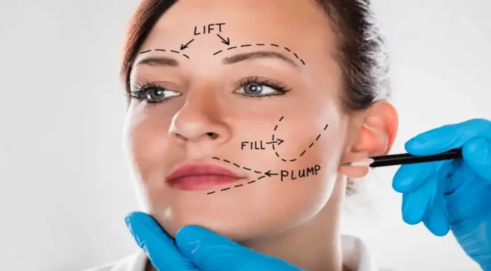 7 important inquiries to ask earlier than beauty surgical procedure