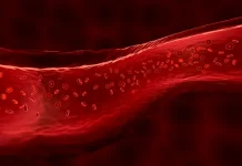 Haemophilia: Signs, prognosis, and efficient administration