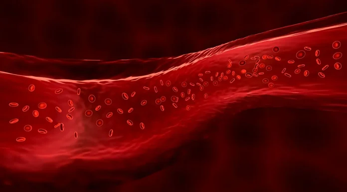 Haemophilia: Signs, prognosis, and efficient administration