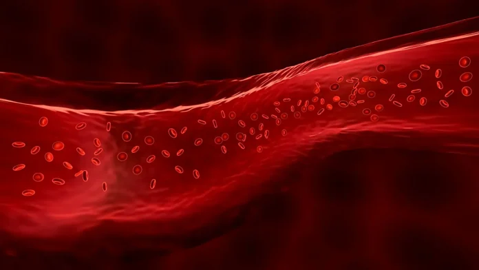 Hemophilia.jpg