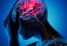 Understanding shift: Strokes in younger adults and methods to act FAST