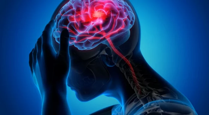 Understanding shift: Strokes in younger adults and methods to act FAST