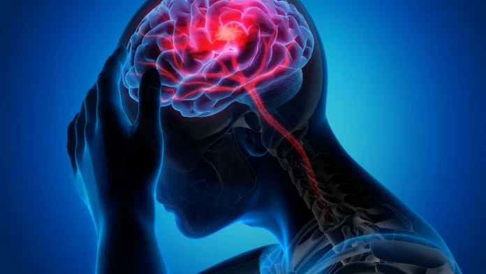 Signs-Symptoms-Stroke.jpg