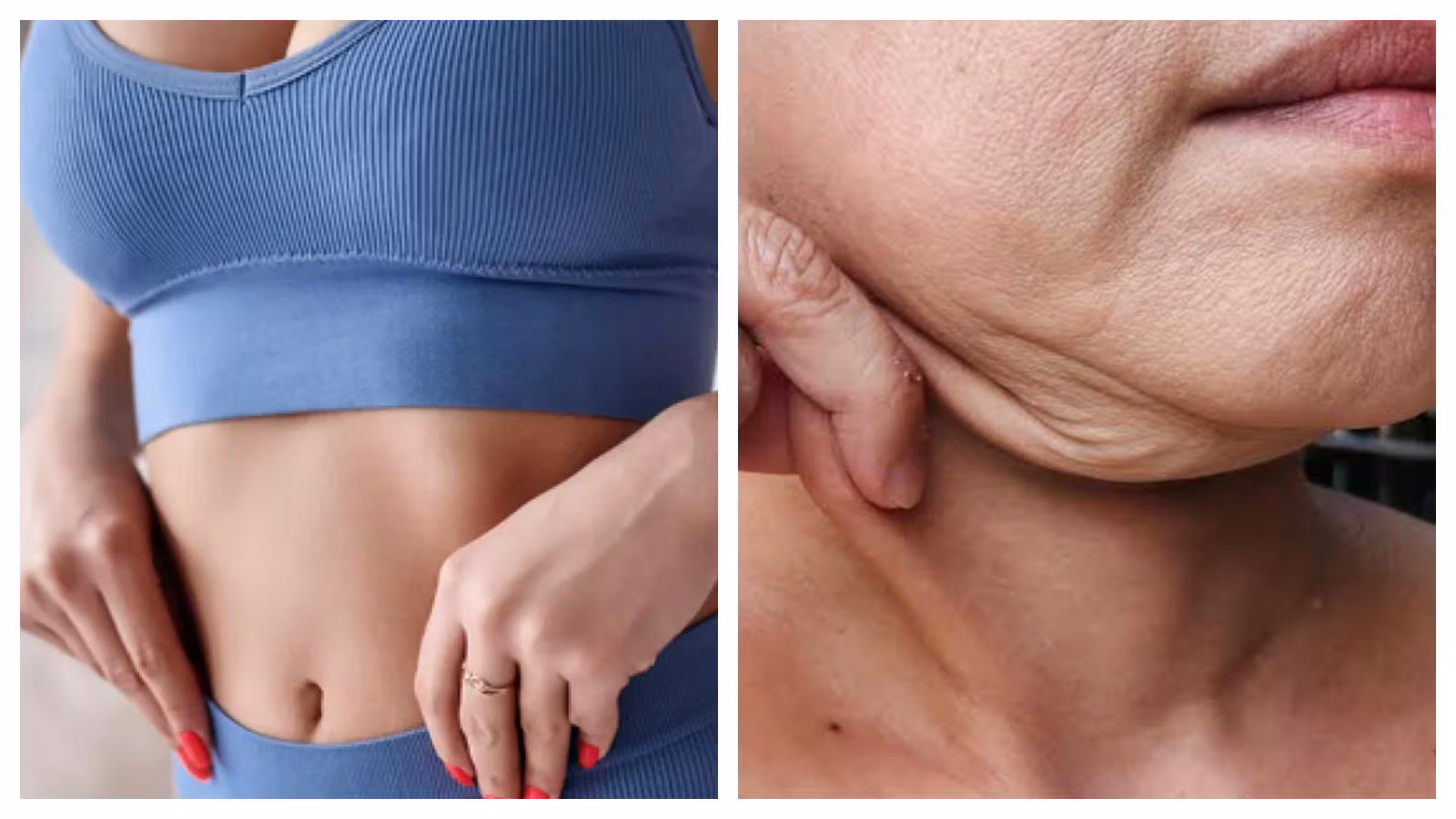 Free pores and skin after weight reduction: Causes, results, and options